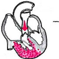 Хроническое легочное сердце рекомендации Легочное сердце пропедевтика внутренних болезней