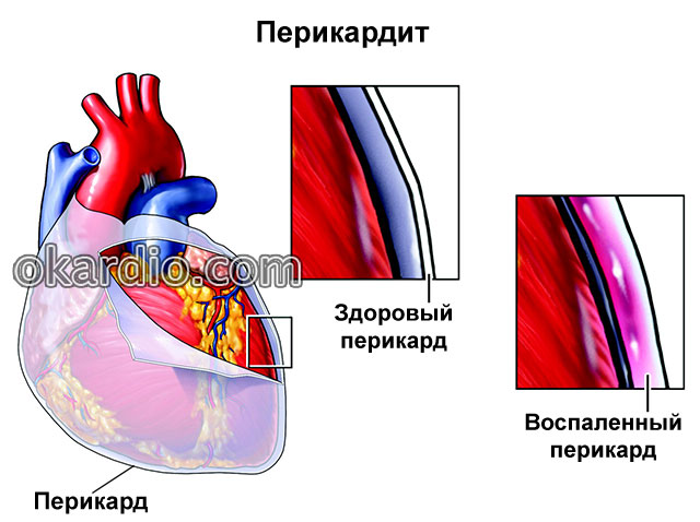 Cardiomagnil - upute za uporabu