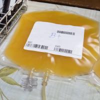Transfusión de trombomasa Transfusión de plaquetas