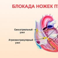 Varietà di aritmia cardiaca e loro trattamento